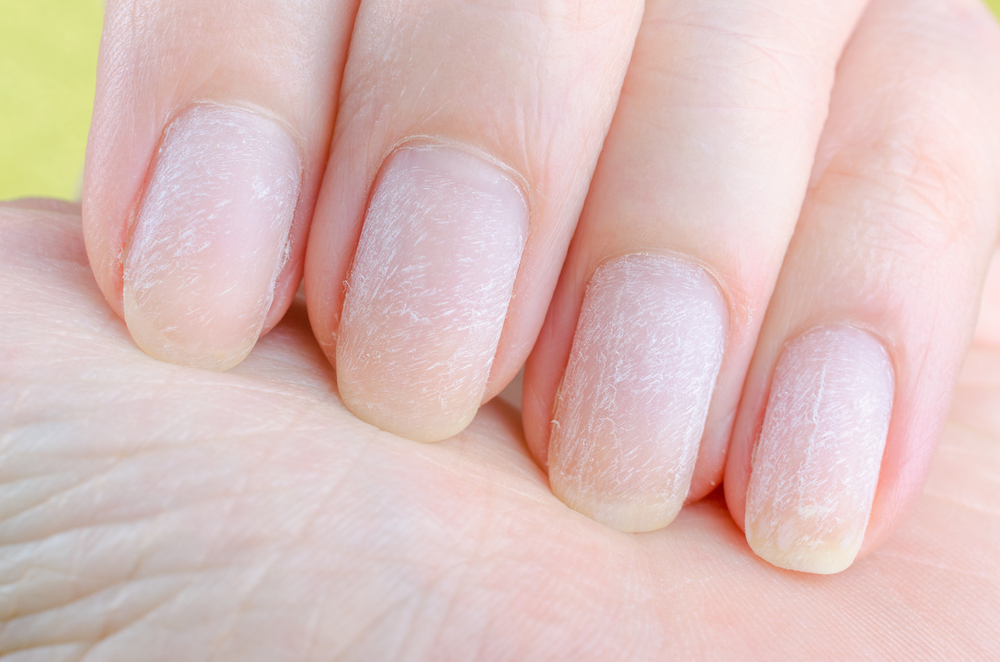 Come curare le unghie rovinate dopo il gel: la routine rinforzante naturale