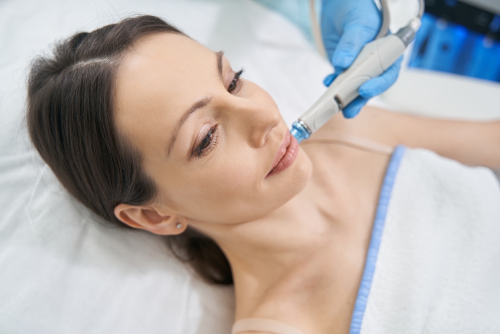 HydraFacial, che cos’è e a chi è consigliato
