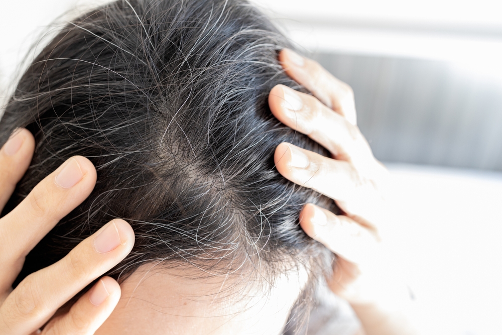 Che succede se si strappano i capelli bianchi?