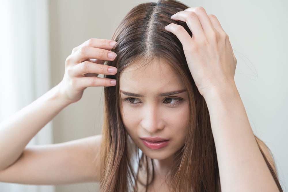 Come trattare l’attaccatura dei capelli diradata