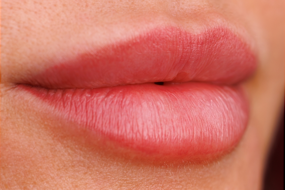 Come ridurre la pigmentazione delle labbra