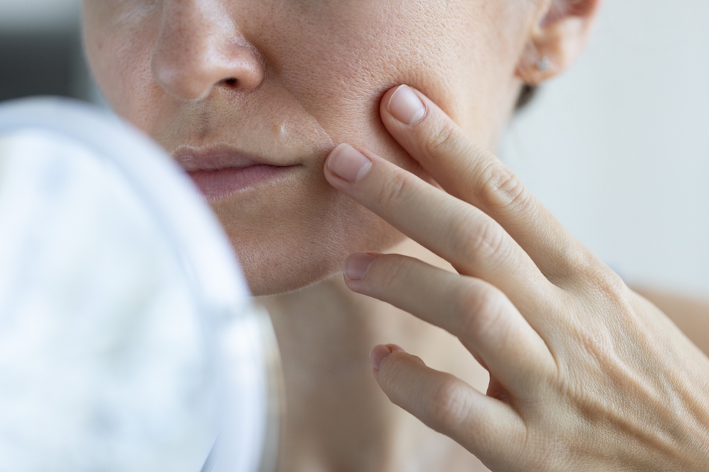 Siero Illuminante Anti-Macchie Barò: come ridurre le discromie e ritrovare una pelle luminosa