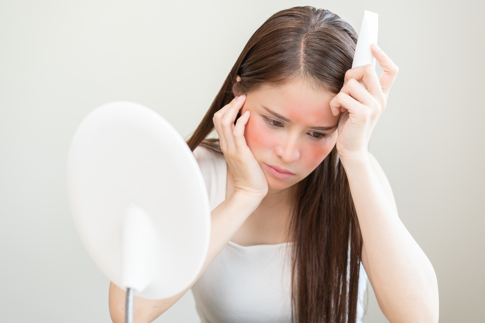 Come eliminare il rossore causato dall’acne
