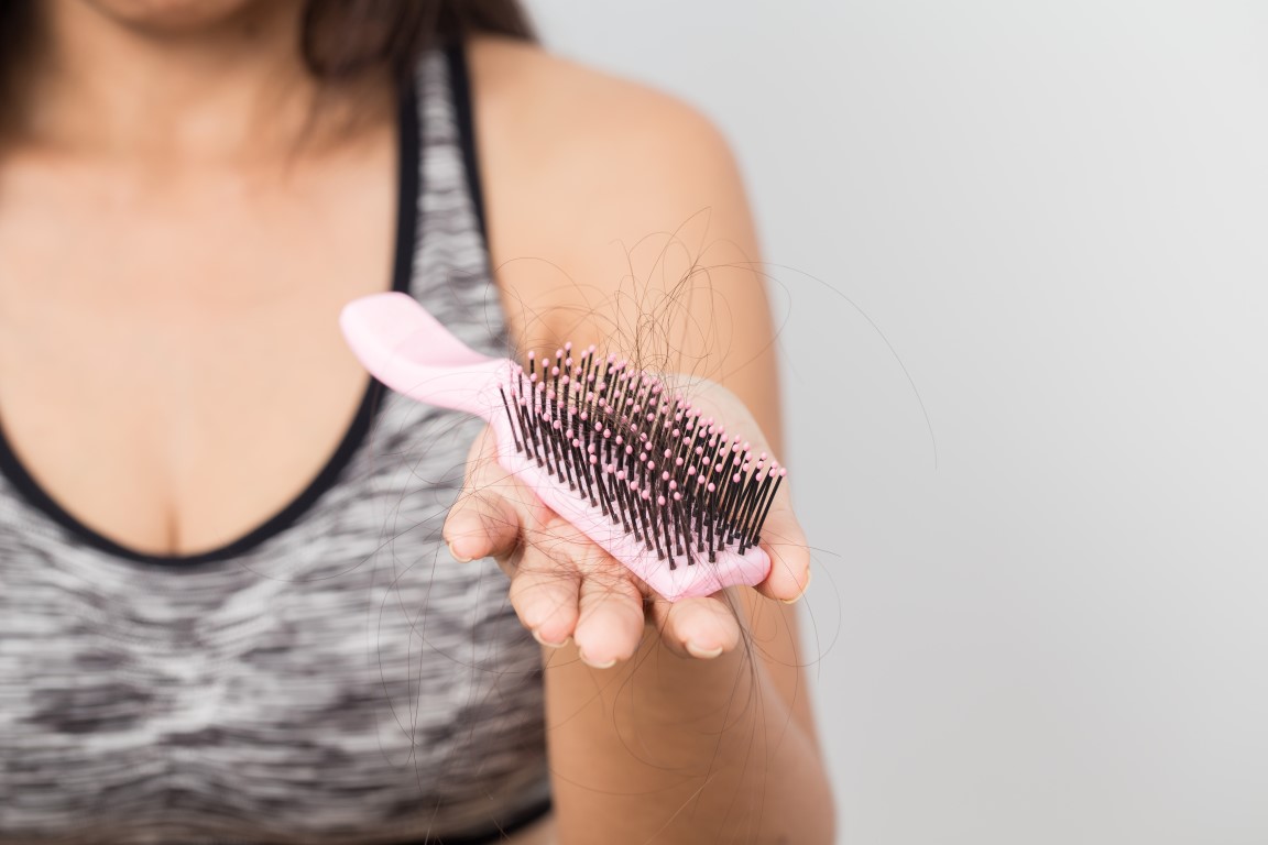 Perdita di capelli nelle donne: gli integratori migliori per frenarla in autunno