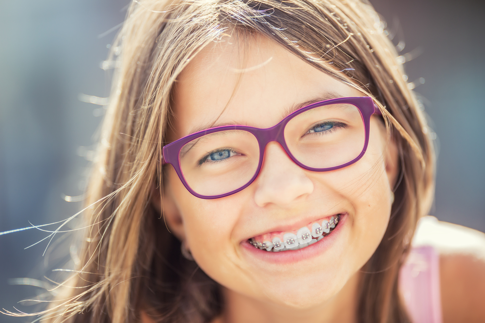 Apparecchio denti per bambini: quando e in quali casi metterlo