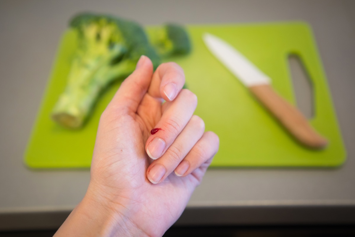Cosa significa sognare di tagliarsi e perdere sangue