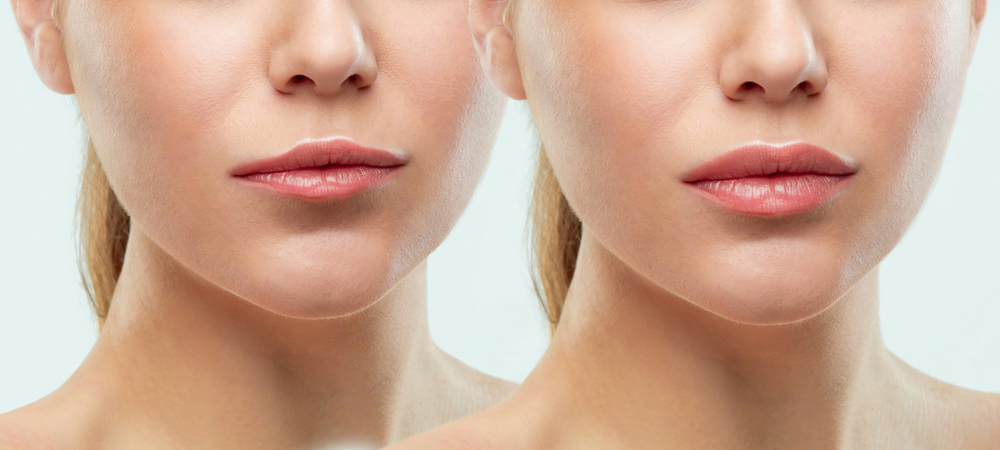 Come truccare le labbra sottili