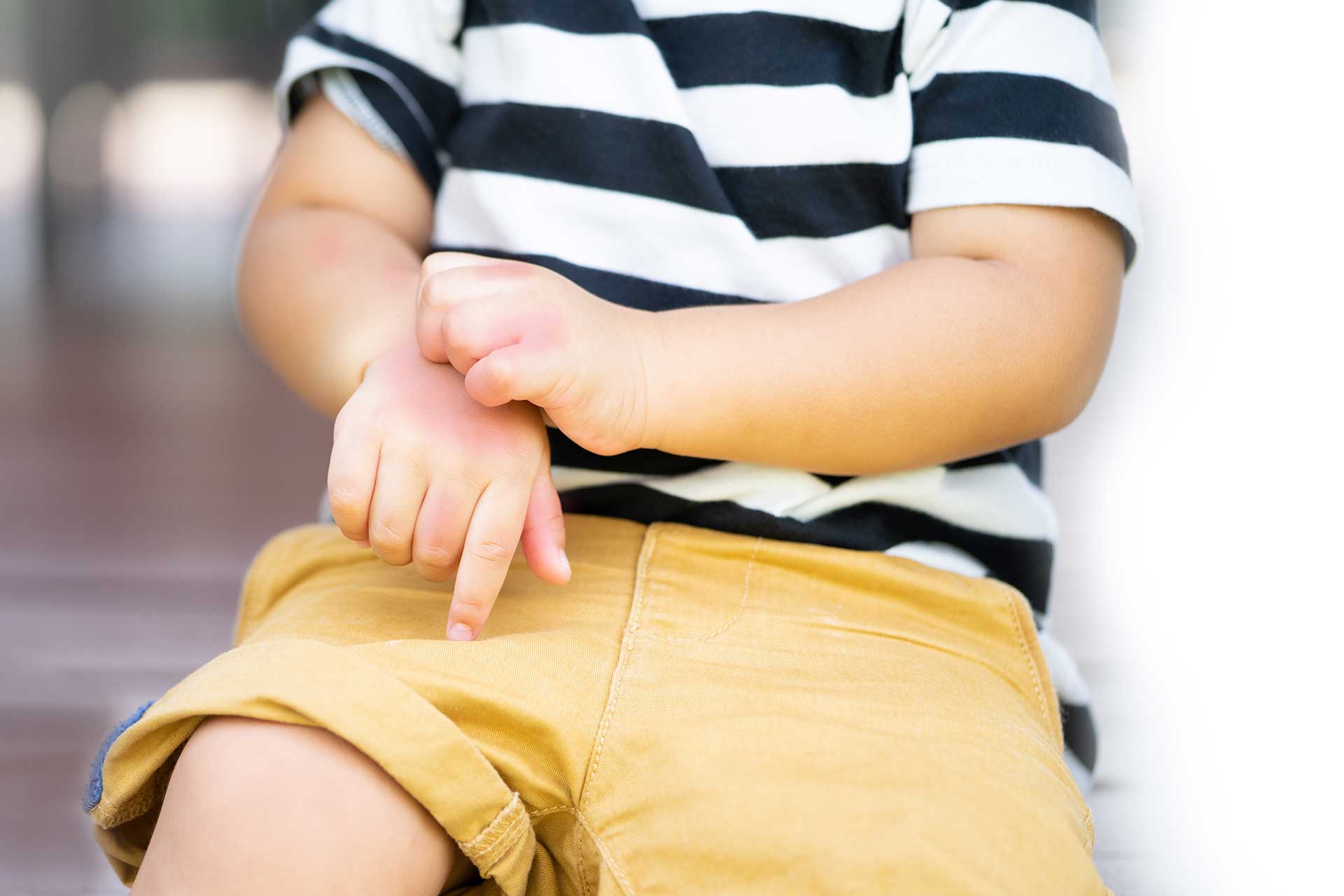 Zanzare come vettori di malattie, tutto quello che devi sapere