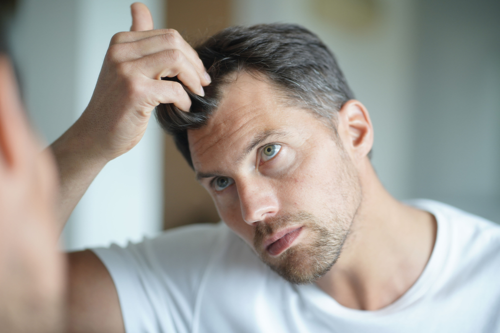 Capelli secchi negli uomini: i consigli per prevenirli