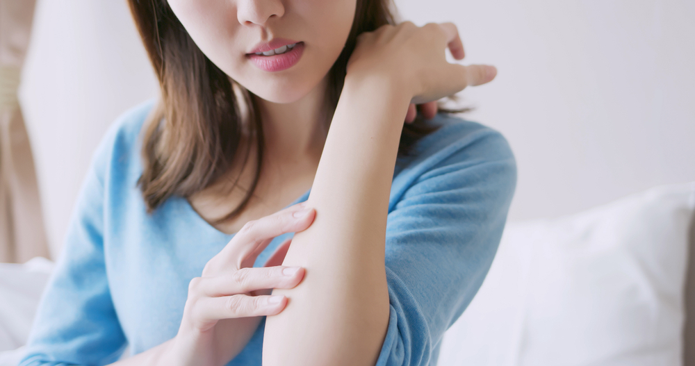 Eczema invernale: 7 consigli per curarlo e prevenirlo