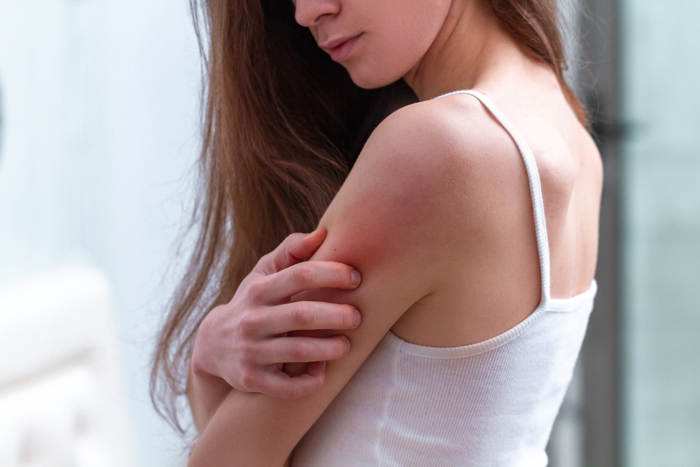 Eczema, 6 cose che non dovresti mai fare