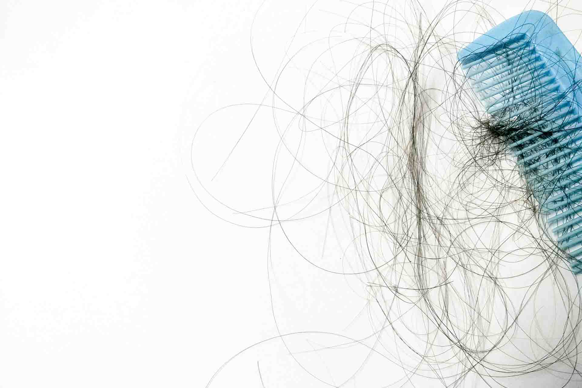 La perdita e caduta di capelli a settembre è normale?
