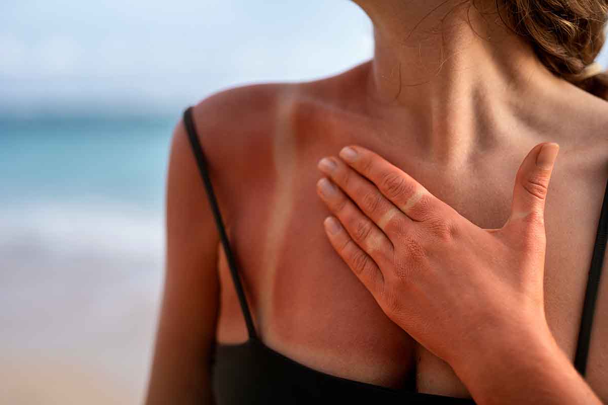 Bikini tape: nastro adesivo per creare segni dell'abbronzatura, i rischi