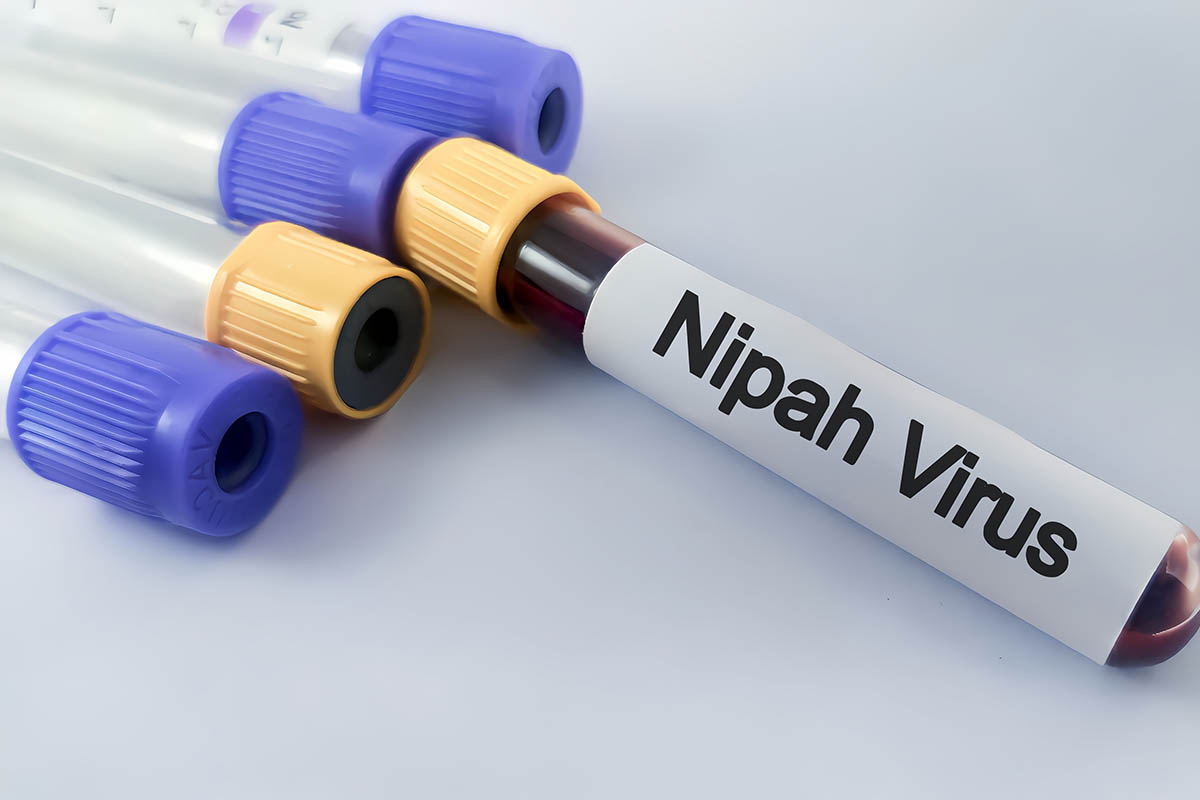 Cos'è il Virus Nipah: cause e sintomi